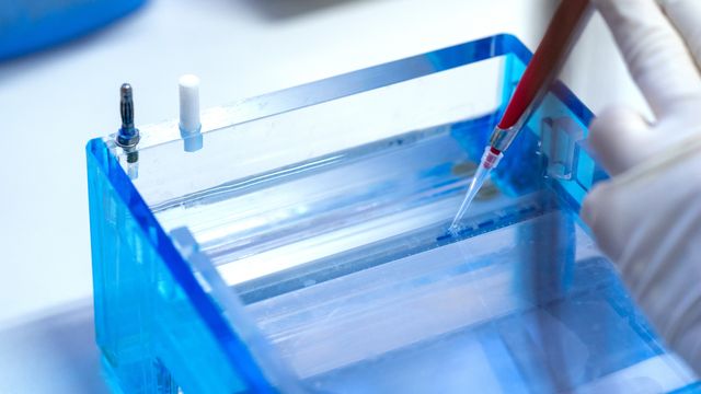 Agarose gel wells being loaded.