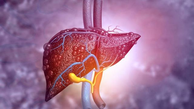 Automated Ultrasound for Non-Invasive Liver Disease Evaluation