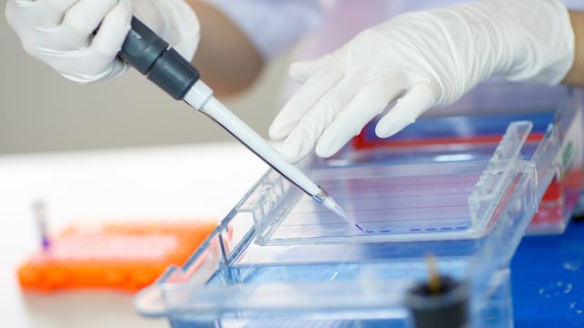 Western Blot