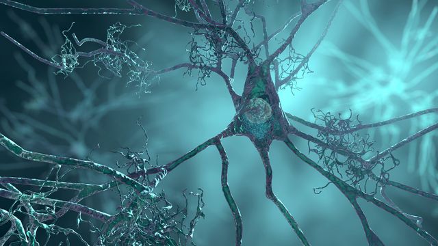 Neurons that look like cobwebs.