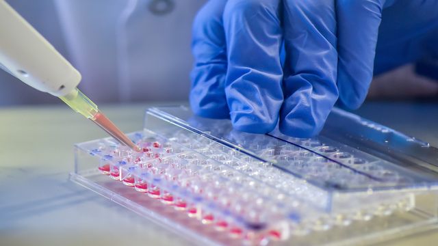 Lateral flow assay