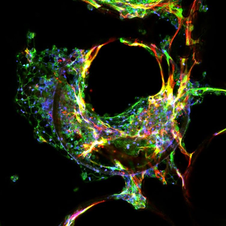 Figure 1: A confocal image of MASH liver tissue generated using MPS. Credit: CN Bio. A confocal image of MASH liver tissue generated using MPS.