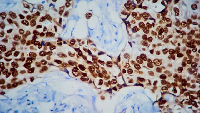 The Role of Mass Spectrometry Imaging in Studying Tumor Metabolism content piece image