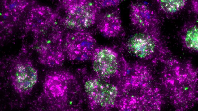 Cells after UV exposure.
