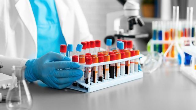 What Is New in Disease Biomarker Discovery? content piece image