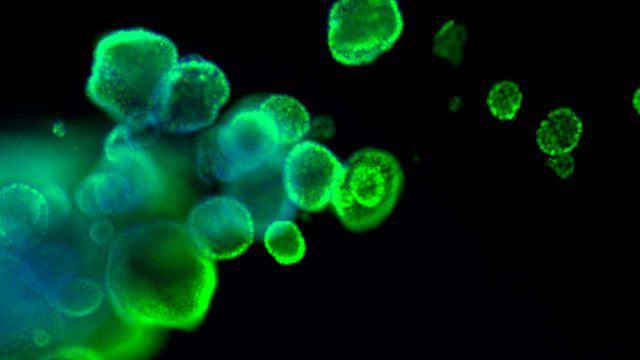 Organoid